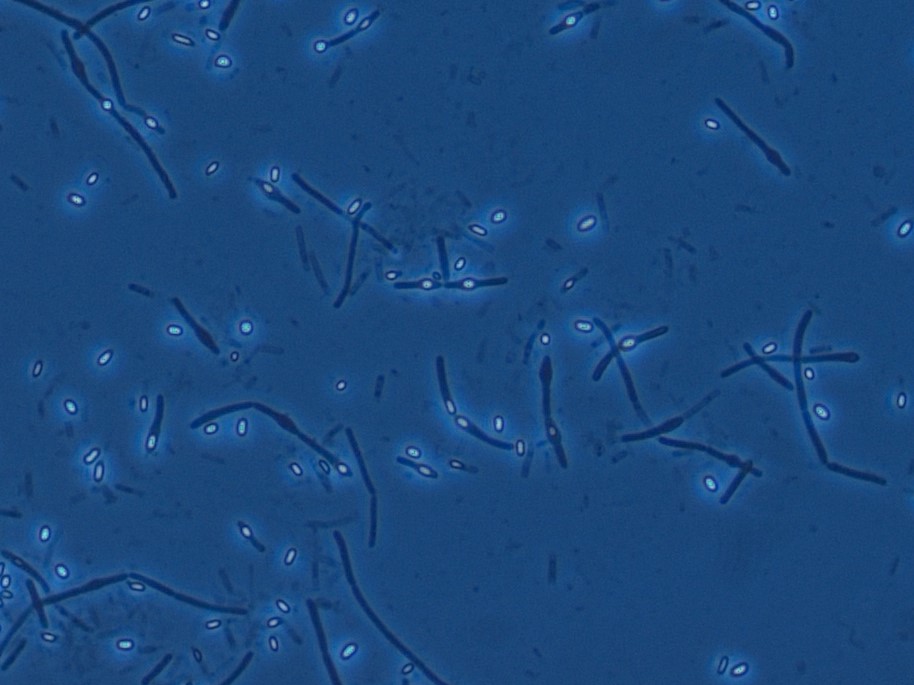 Bacillus spp.