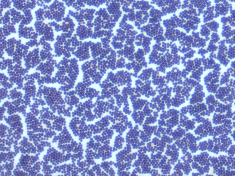 Gram-positive Kokken