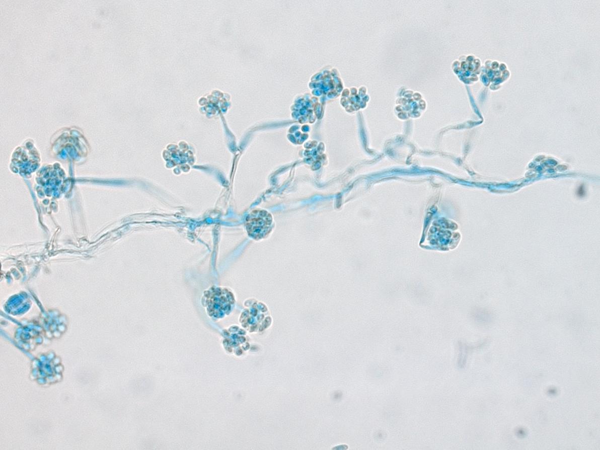 Acrostalagmus